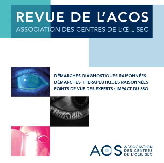 Publication dans l'ACOS : Lentilles sclérales et syndrome sec oculaire